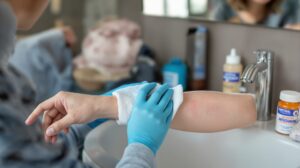 comment soulager l urticaire